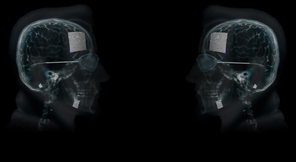 Dude X-Ray