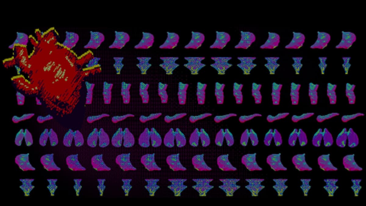 Organ Ballet